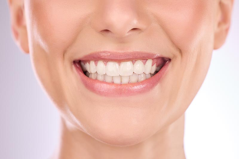 Dental Implants vs Bridges: Pros and Cons for Permanent Tooth Replacement Solutions