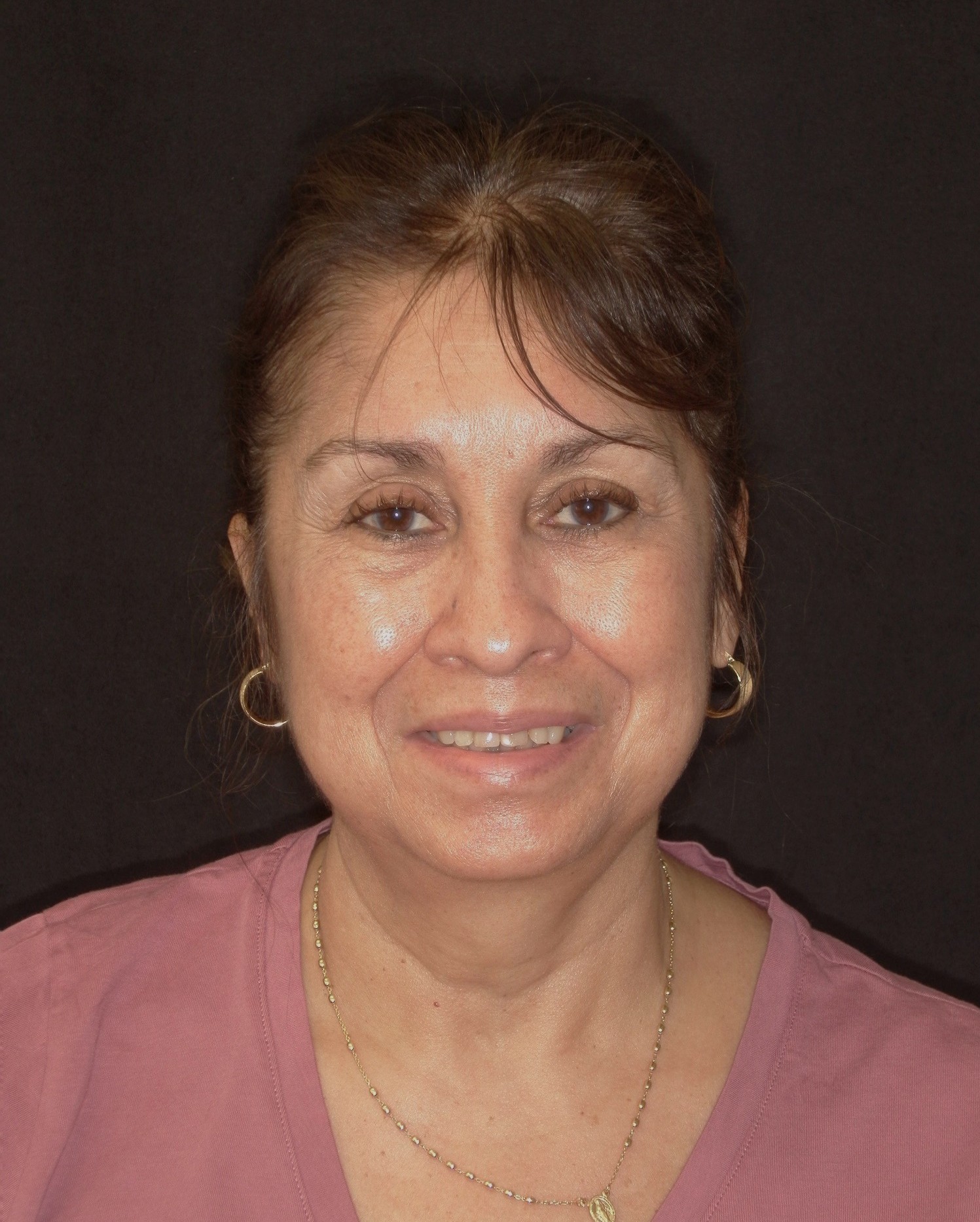 Cosmetic Dentures