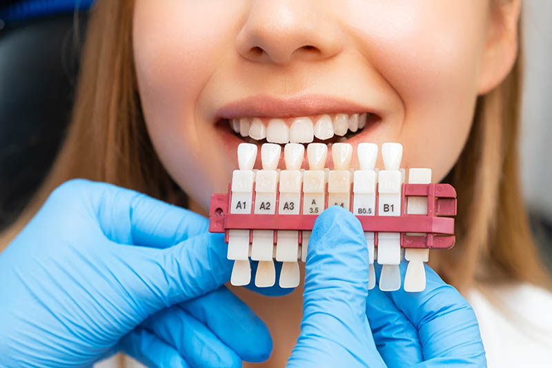 Veneers: Enhance Your Smile with Custom Cosmetic Solutions
