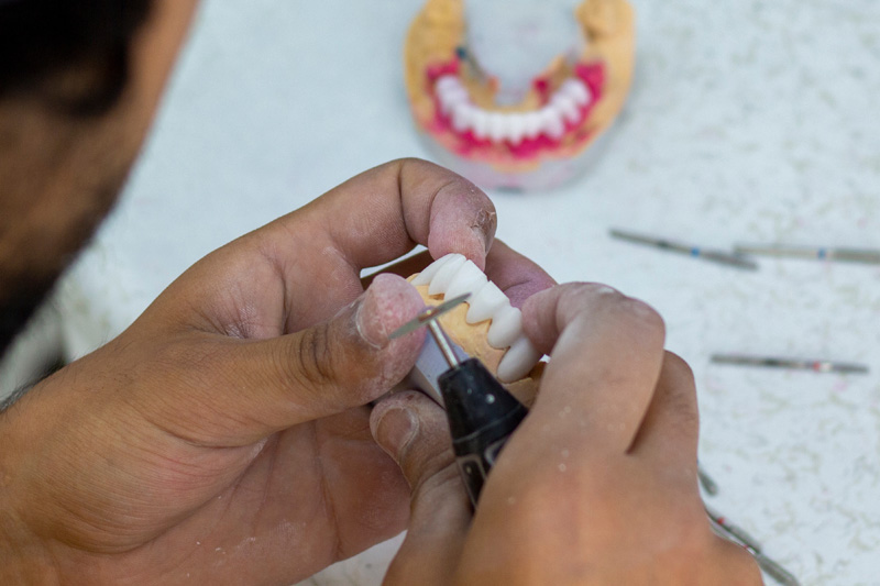 denture making