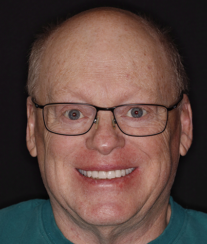 Dentures