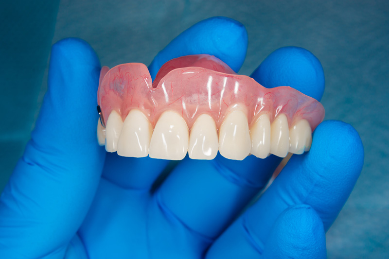 denture