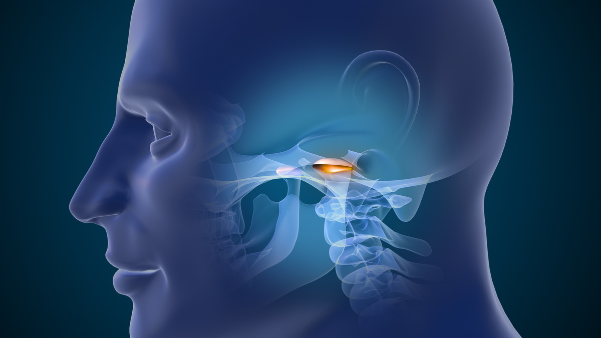 3D Medical Animation of TMJ Joint Disorder