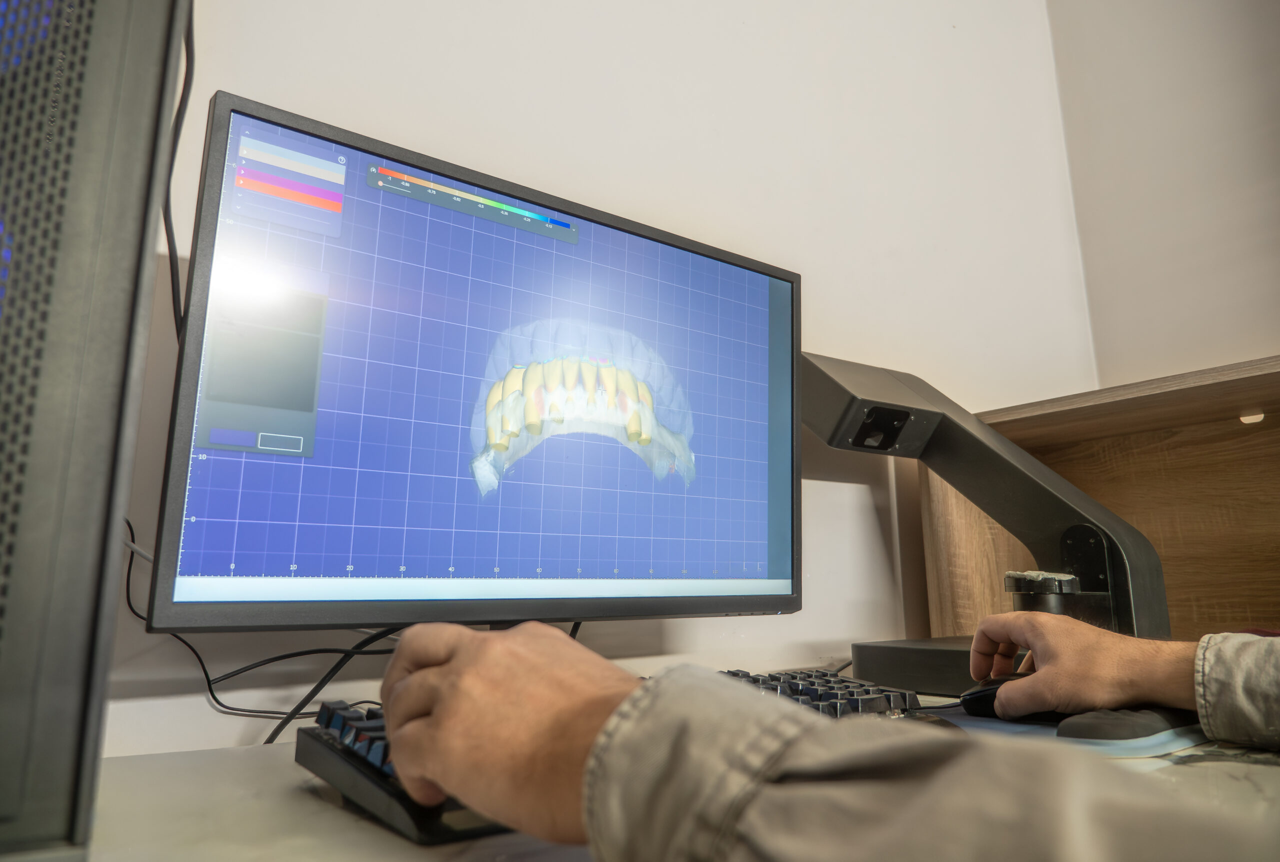 Digital dental design 3D modeling of teeth using CAD CAM software for creating metal-ceramic dental crowns, prosthodontics, computer-aided design.